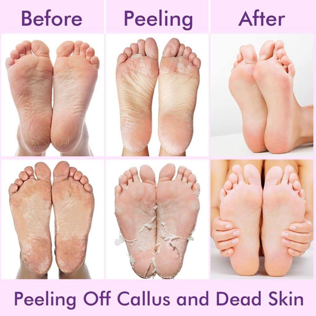 Foot Peel Mask – Soft Smooth Feet